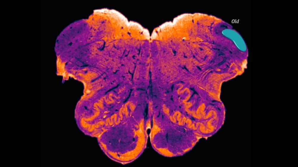 Region of the Brain That Likely Impacts Fine Motor Control Discovered