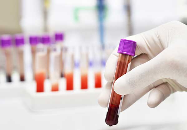 blood biomarker testing
